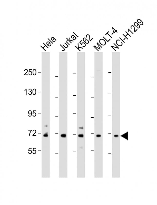 NUP85 / Pericentrin 1 Antibody (N-Terminus)