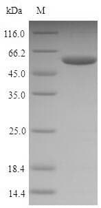 Mouse NPM1 / NPM / Nucleophosmin Protein (Recombinant 6His-SUMO, N-terminus)