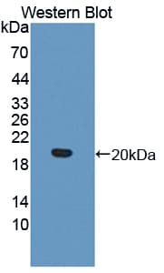 IL17RB Antibody (aa61-200)