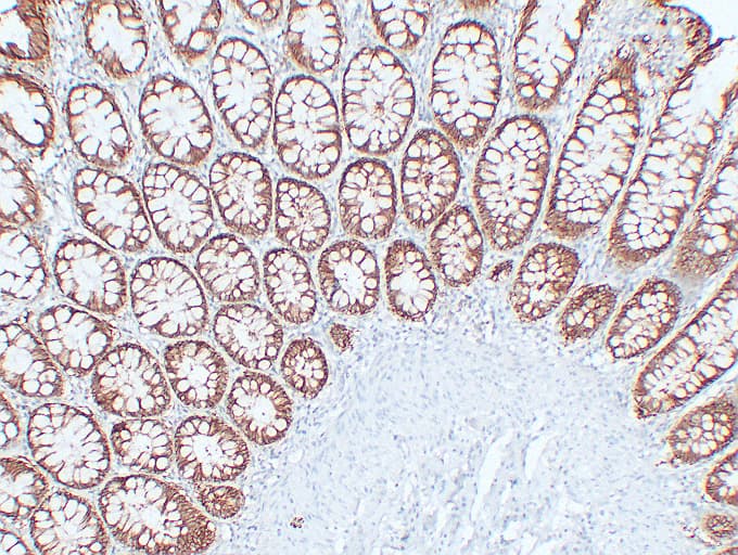 EPCAM Antibody (clone ABT-EPCAM)