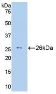 Human GZMM / Granzyme M Protein (Recombinant His, N-Terminal)