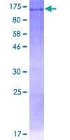 Human DDX11 / CHLR1 Protein (Recombinant GST)
