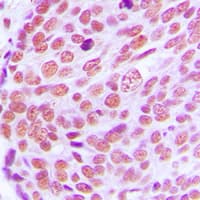 Polyclonal Rabbit anti-Human LMNA / Lamin A+C Antibody (Internal, IHC, WB)