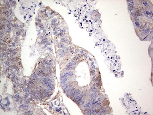 LGALS3 / Galectin 3 Antibody (clone OTI21C1)