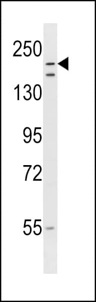 LTN1 / RNF160 Antibody (aa1087-1115)