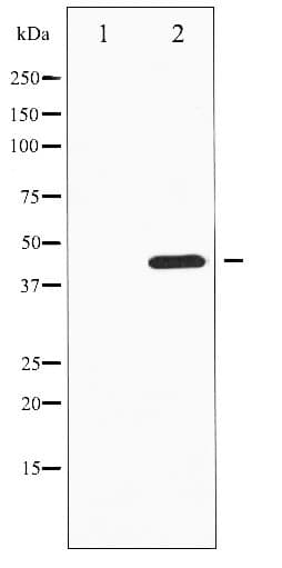 MKP1 + MKP2 Antibody (phospho-Ser296/318)