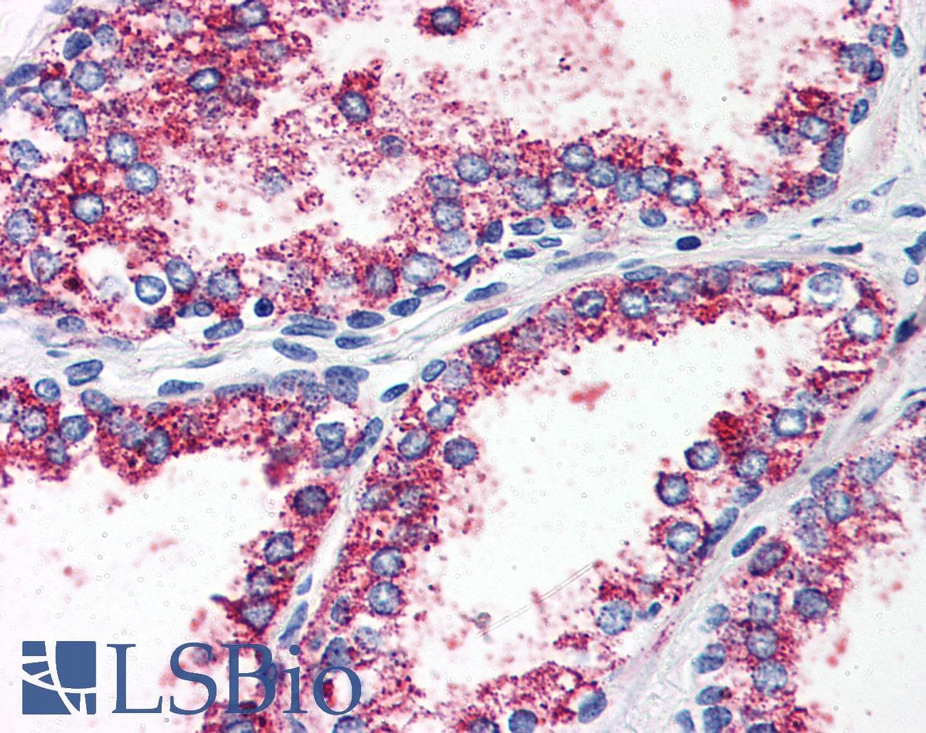 IHC-plus™ Polyclonal Rabbit anti-Human HTR2A / 5-HT2A Receptor Antibody (N-Terminus, IHC)