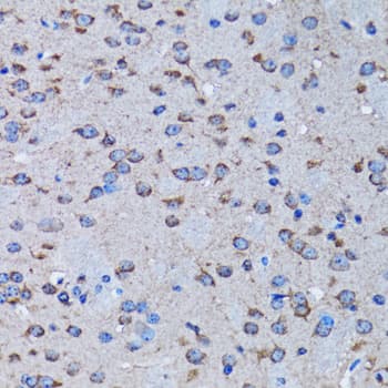 Polyclonal Rabbit anti-Human IRAK4 / IRAK-4 Antibody (IHC, WB)