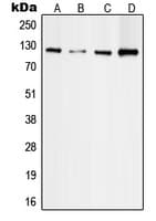 FAK / Focal Adhesion Kinase Antibody (Internal)