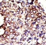 Polyclonal Rabbit anti-Human GCNT1 / C2GNT Antibody (aa88-117, IHC, WB)