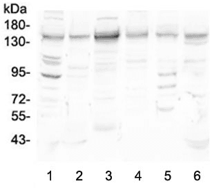 HDAC5 Antibody