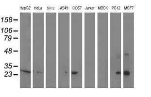 SIRT5 / Sirtuin 5 Antibody (clone OTI2F1)