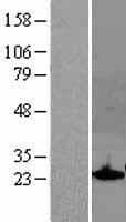 Human SOCS1 Protein (Over-Expression Lysate Myc-DDK (Flag))