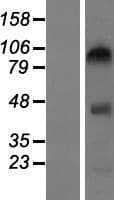 CEP104 Protein (Over-Expression Lysate Myc-DDK (Flag))
