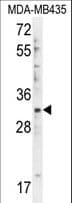 Polyclonal Rabbit anti-Human DTWD1 Antibody (aa144-173, WB)