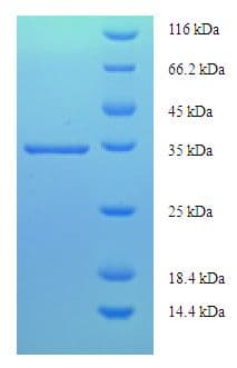 Human Prostaglandin D Synthase Protein (Recombinant His-SUMO)