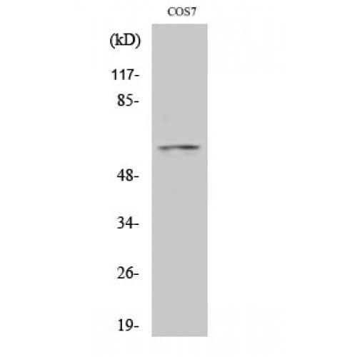 FOXO4 / AFX1 Antibody (390-470 aa)