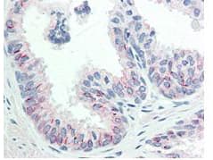 AKT1 Antibody (phospho-Ser473, clone 17F6.B11)