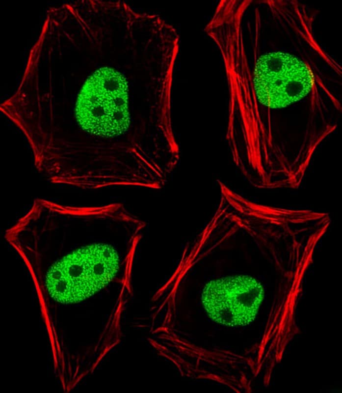 TLE1 / TLE 1 Antibody (aa187-221)