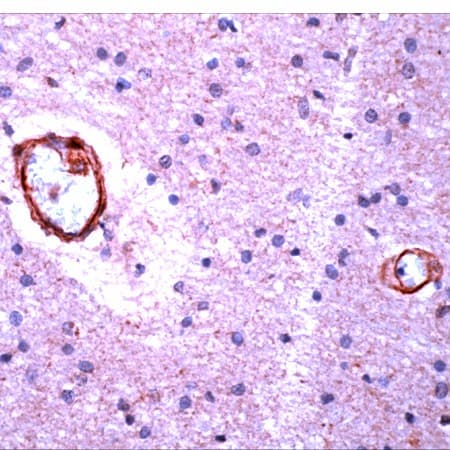 APP / Beta Amyloid Precursor Antibody (N-Terminus)