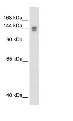 TP53BP2 / ASPP2 Antibody (aa133-182)