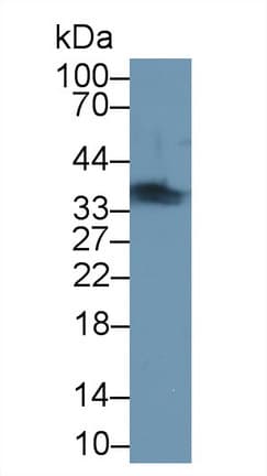 TNNT1 / TNT Antibody (aa1-228)