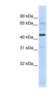 Polyclonal Rabbit anti-Human KIAA0930 Antibody (aa288-337, WB)