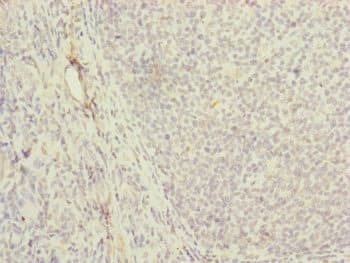 Polyclonal Rabbit anti-Human MRPS16 Antibody (IHC, WB)