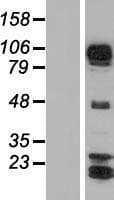 AFAP1L1 Protein (Over-Expression Lysate Myc-DDK (Flag))