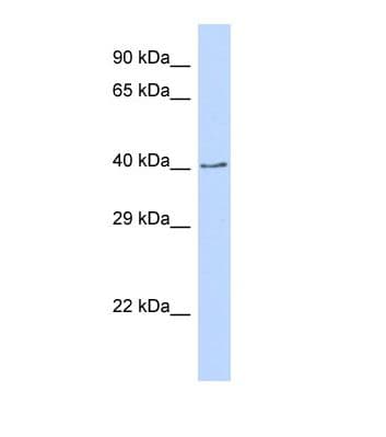 CDS2 Antibody (aa172-221)