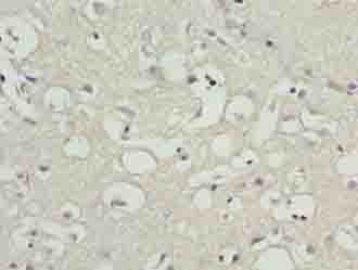 CNIH3 Antibody