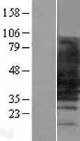SLC10A1 / NTCP Protein (Over-Expression Lysate Myc-DDK (Flag))
