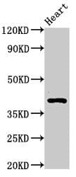 Polyclonal Rabbit anti-Human MECR Antibody (aa211-373)