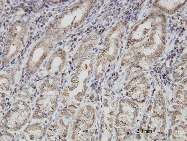 Monoclonal Mouse anti-Human PNMA1 / MA1 Antibody (clone 4G6, IHC, WB)