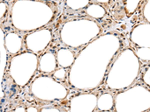 RAB11A Antibody