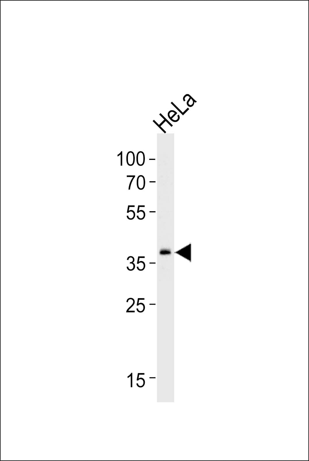 SRPX Antibody (aa218-246)