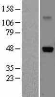 IL5RA / CD125 Protein (Over-Expression Lysate Myc-DDK (Flag))