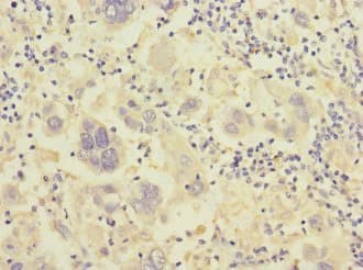 ITGB7 / Integrin Beta 7 Antibody