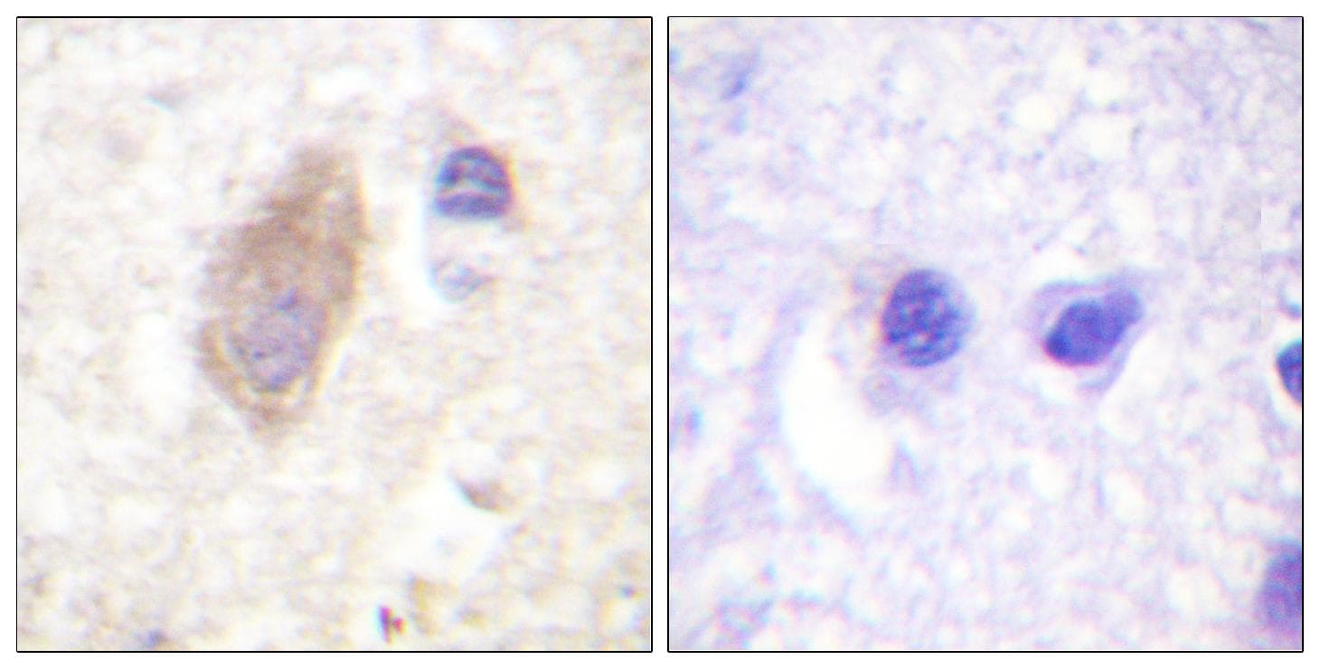 RPH3A / Rabphilin 3A Antibody (phospho-Ser237)