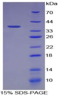 Pig GPT / Alanine Transaminase Protein (Recombinant His-GST)