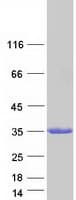 Human RAB27A / RAB27 Protein (Recombinant Myc-DDK (Flag))