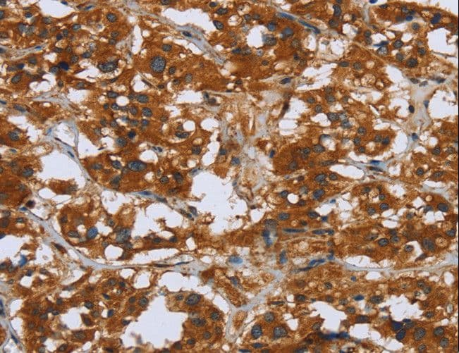 COMP / THBS5 Antibody