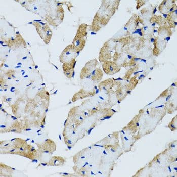 GABARAP Antibody