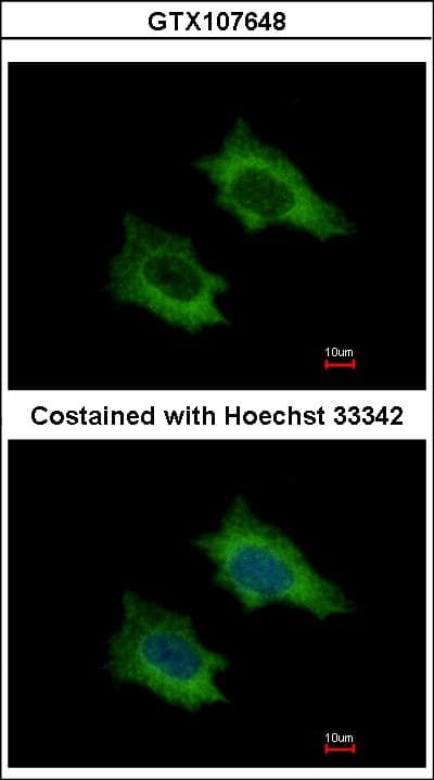PRPSAP2 Antibody (aa1-369)