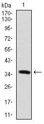 MAP2 Antibody (Amino Acid: 24-123, clone 5B7)