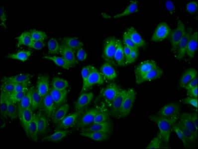 TIRC7 / TCIRG1 Antibody