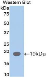 I-FABP / FABP2 Antibody (aa2-132)