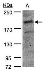 CDC42BPA / MRCK Antibody (aa373-564)