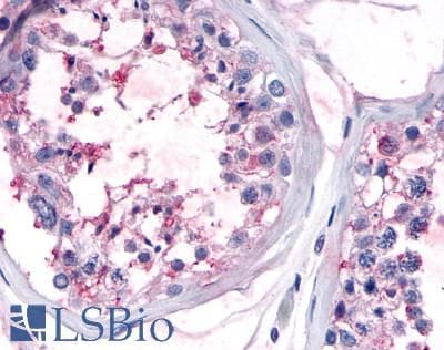 PathPlus™ OR10R2 Antibody (C-Terminus)