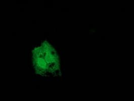 CNDP1 Antibody (clone OTI1A5)